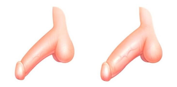 Tag a növekedés előtt és után